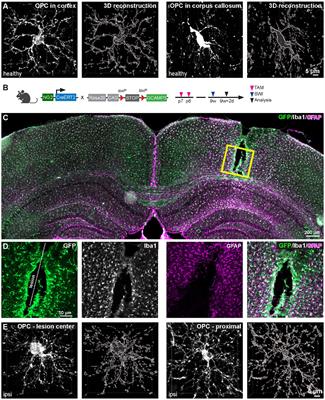 Unlocking the Potential: immune functions of oligodendrocyte precursor cells